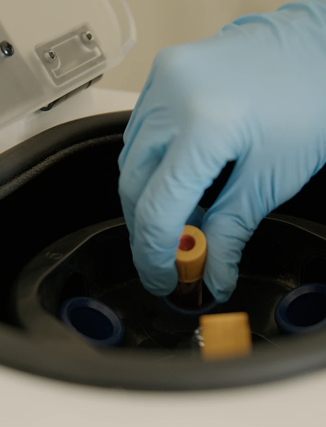 Blood Work Being Placed Into Machine